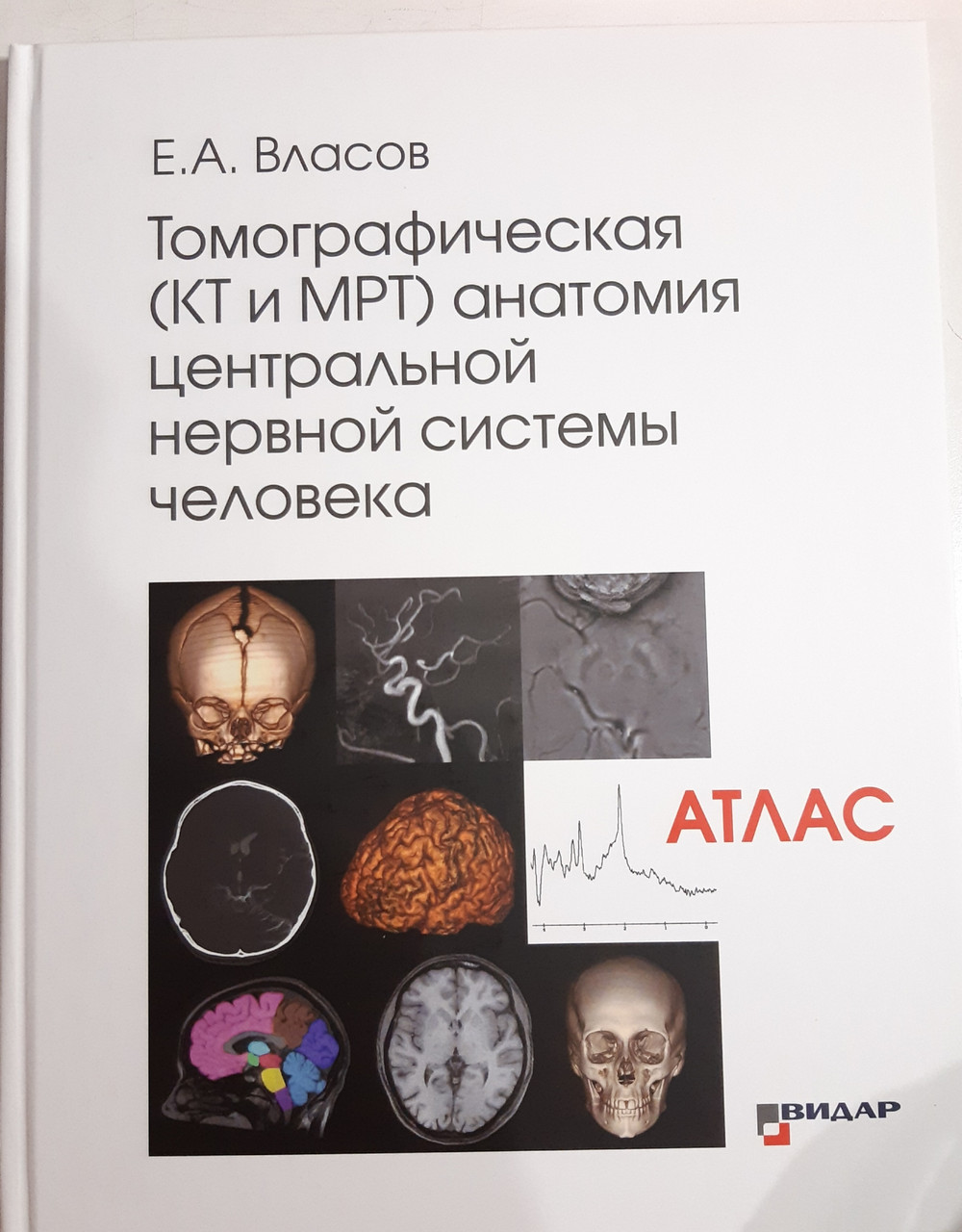 

Власов Е.А. Томографическая КТ и МРТ анатомия центральной нервной системы человека Атлас 2020 год (978-5-88429-255-0) Изд. Видар-М