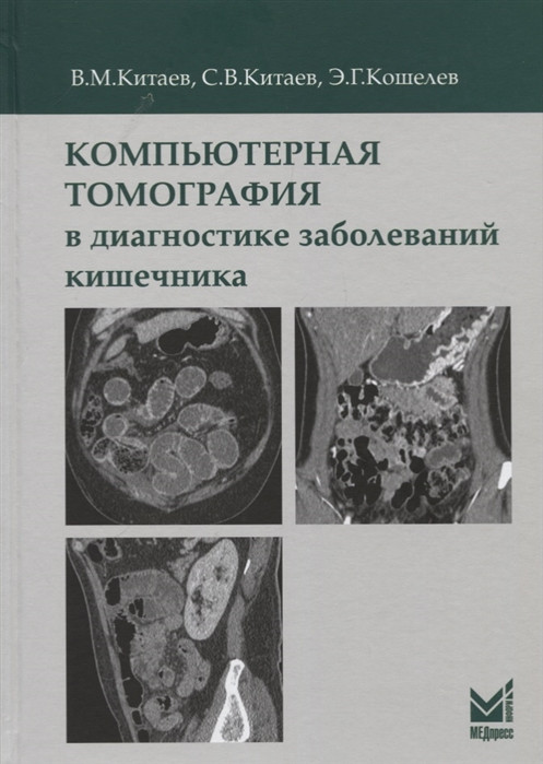 

Китаев. Компьютерная томография в диагностике заболеваний кишечника 2020г (978-5-00030-734-2) Изд. МЕДпресс-информ