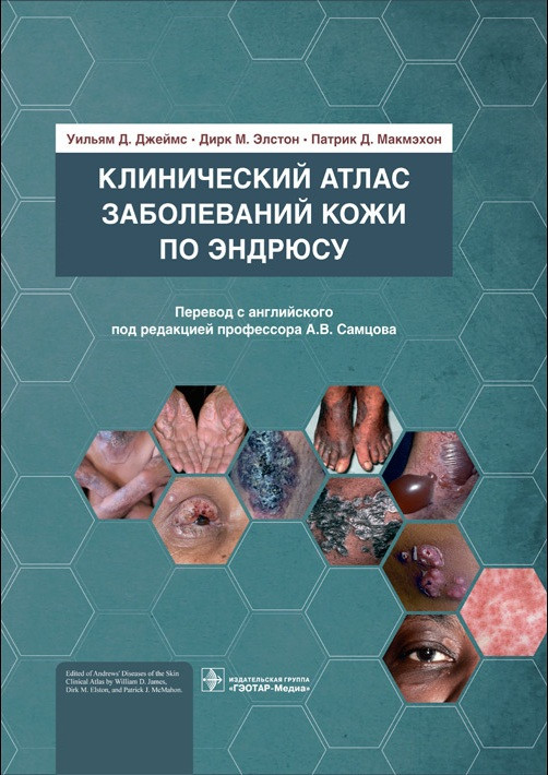 

Джеймс, Элстон, Макмэхон Клинический атлас заболеваний кожи по Эндрюсу 2021 год под ред Самцова (978-5-9704-6112-9) Изд. ГЭОТАР-Медиа