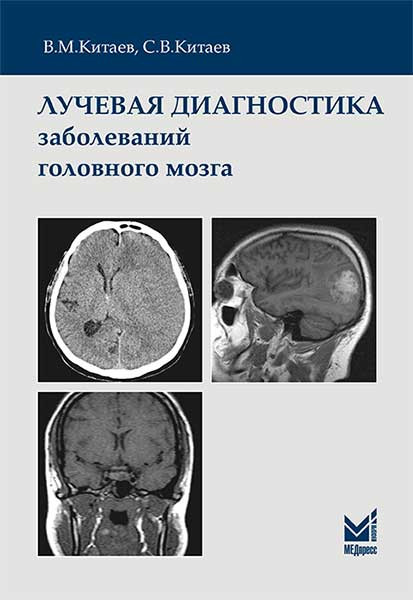 

Китаев В.М. Лучевая диагностика заболеваний головного мозга (978-5-00030-536-2) Изд. МЕДпресс-информ