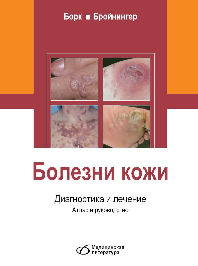 

Болезни кожи. Диагностика и лечение. Атлас и руководство - Борк К. (978-5-89677-177-7) Изд. Медицинская литература
