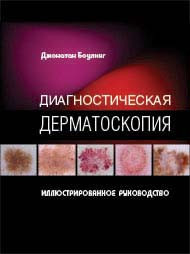 

Боулинг Джонатан Диагностическая дерматоскопия. Иллюстрированное руководство (978-5-91839-020-7) Изд. Издательство Панфилова