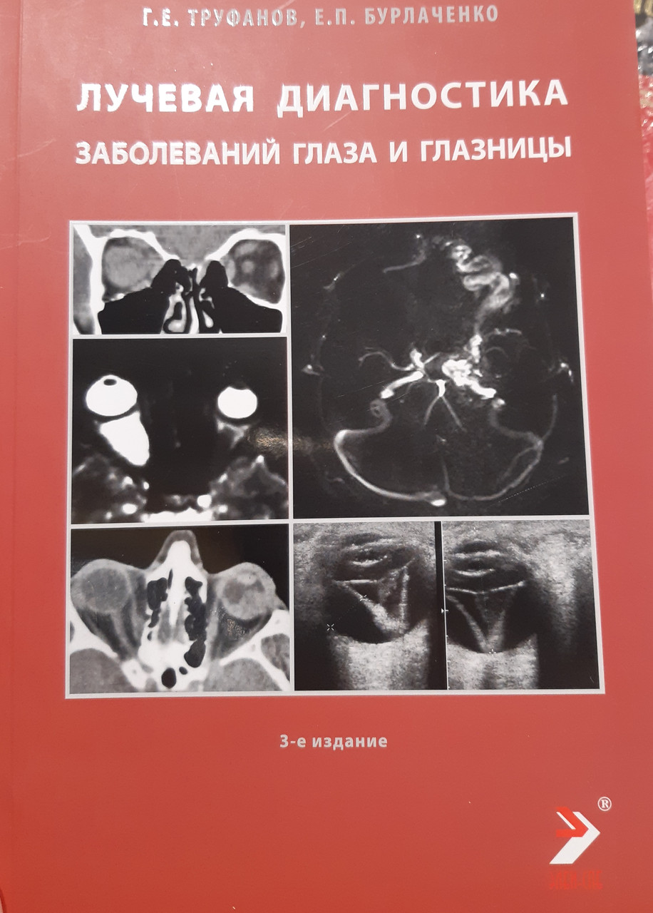 

Труфанов Г.Е. Лучевая диагностика заболеваний глаза и глазницы 2020г (978-5-6044262-3-4) Изд. ЭЛБИ-СПб