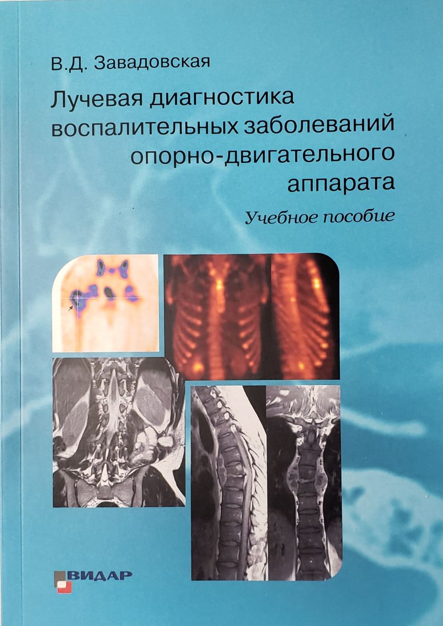 

В.Д. Завадовская. Лучевая диагностика воспалительных заболеваний опорно-двигательного аппарата. (978-5-88429-245-1) Изд. Видар