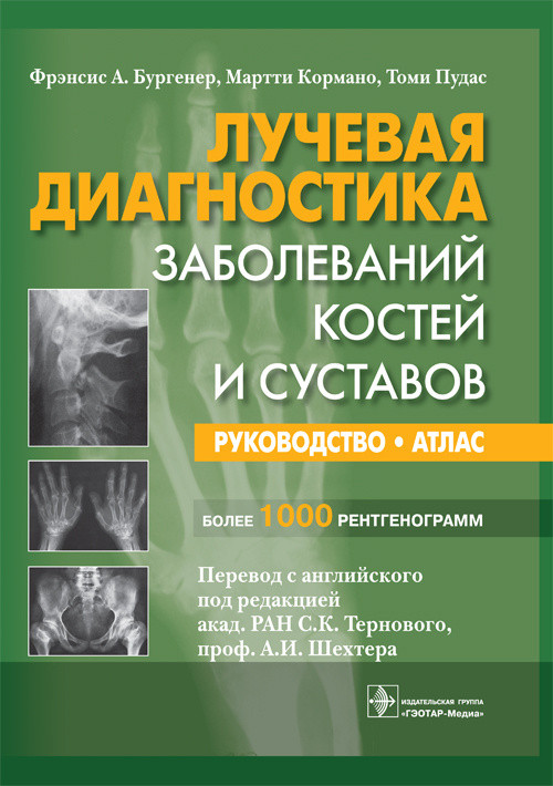 

Бургенер Ф.А., Кормано М., Пудас Т. Лучевая диагностика заболеваний костей и суставов. Атлас 2017 год (978-5-9704-4158-9) Изд. ГЭОТАР-Медиа