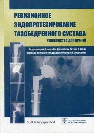 

Джакофски Дж., Хедли Э.К. Ревизионное эндопротезирование тазобедренного сустава. Руководство для врачей. (978-5-9704-2966-2) Изд. ГЭОТАР-Медиа