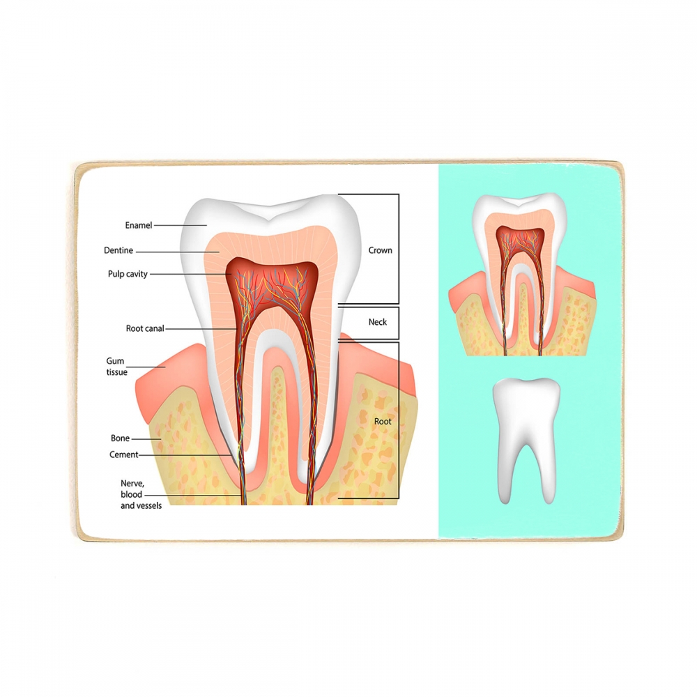 

Деревянный постер Стоматология Tooth Structure А1