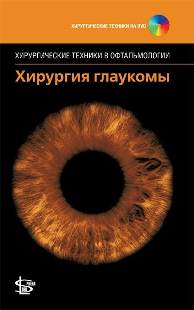 

Чен Т. Хирургия глаукомы + CD