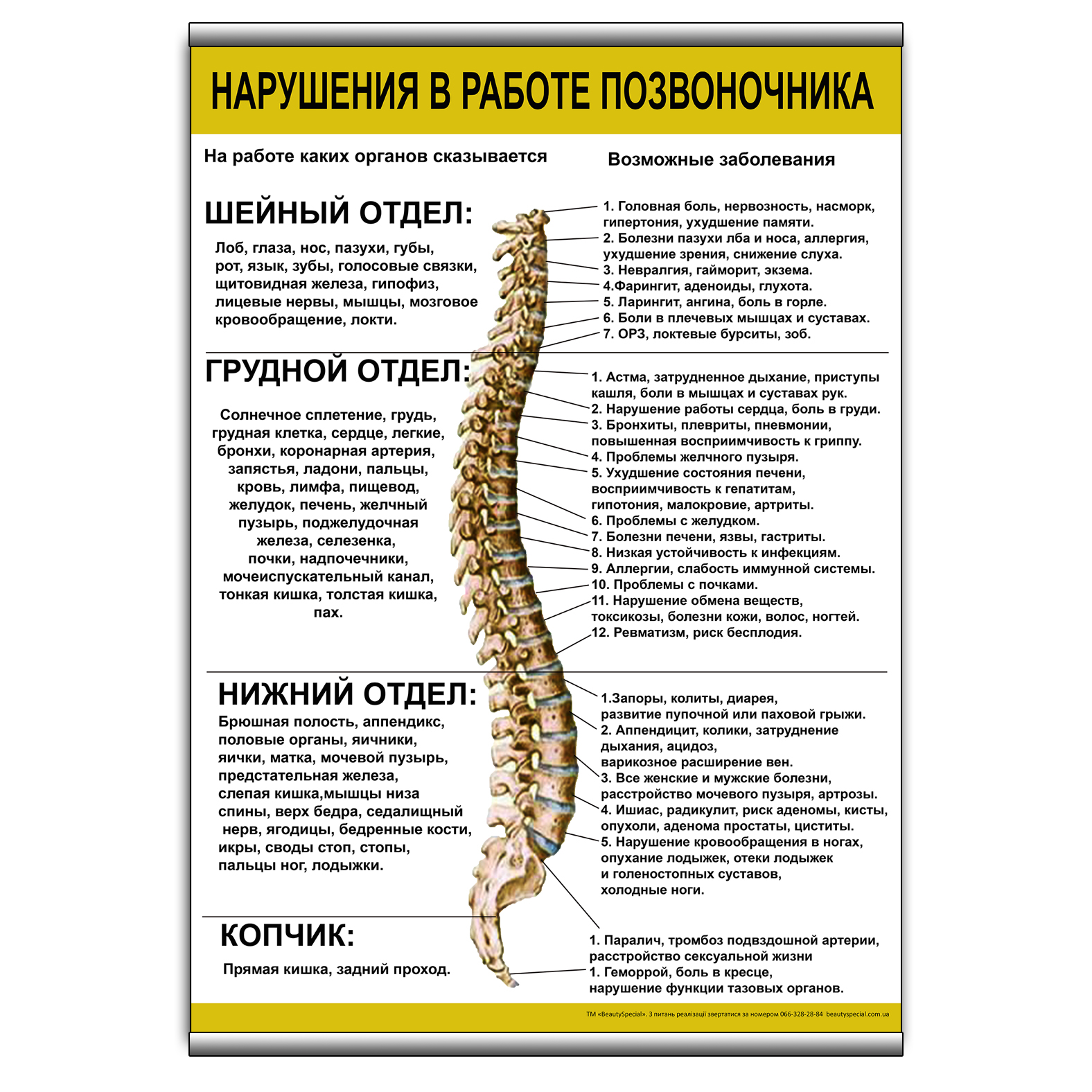 

Плакат Beauty Special "Нарушения в работе позвоночника" с планкой А0 (8911)