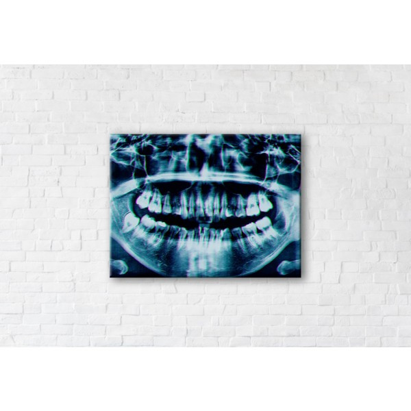 

Картина на холсте прямоугольная I-Art X-ray Image 50x65см