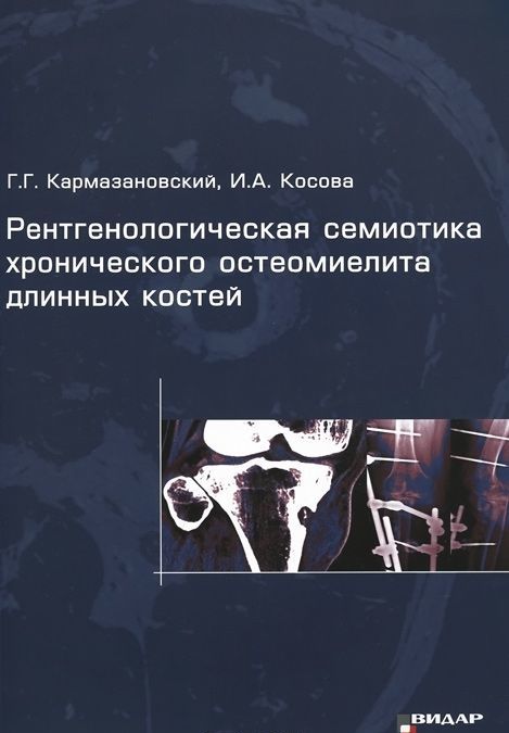 

Рентгенологическая семиотика хронического остеомиелита длинных костей. Кармазановский Г.Г.