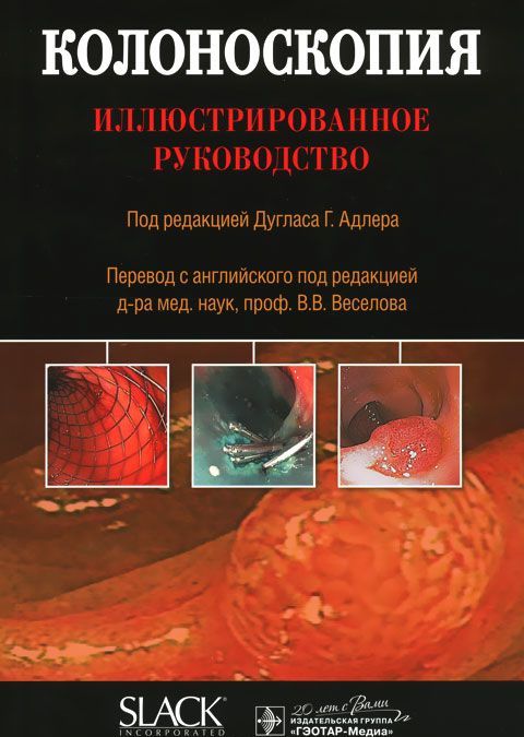 

Колоноскопия. Иллюстрированное руководство (1024732)