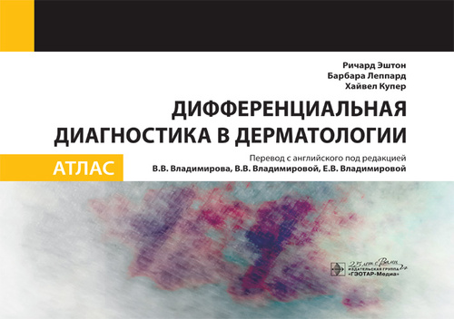 

Дифференциальная диагностика в дерматологии. Атлас