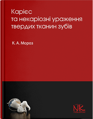 

Карієс та некаріозні ураження твердих тканин зубів. Мороз К. А.