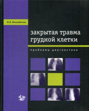 

Закрытая травма грудной клетки. Проблемы диагностики