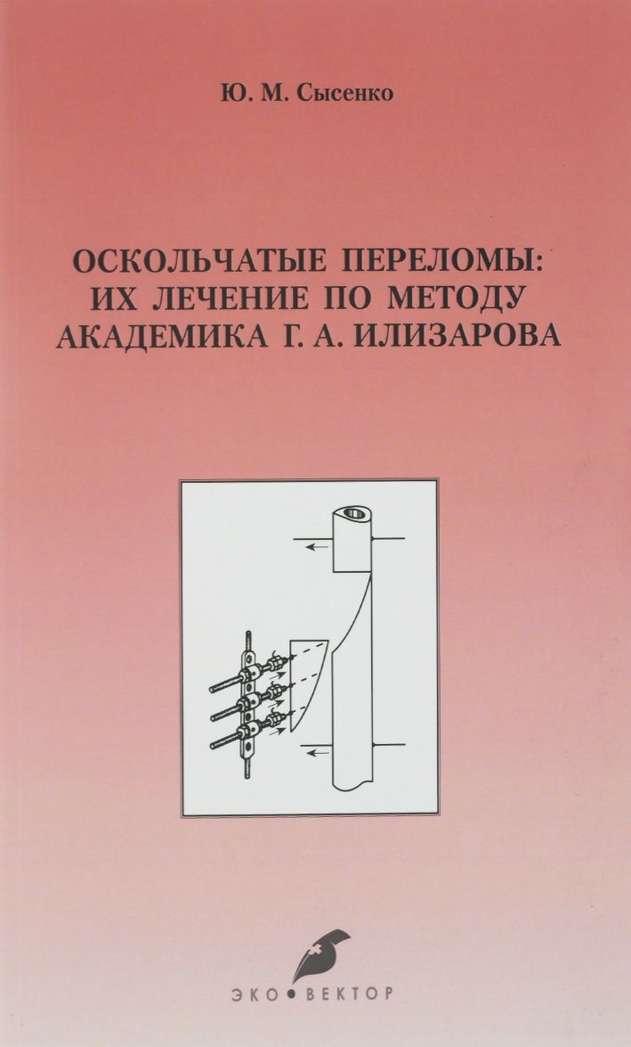 

Оскольчатые переломы. Их лечение по методу академика Г. А. Илизарова. Монография