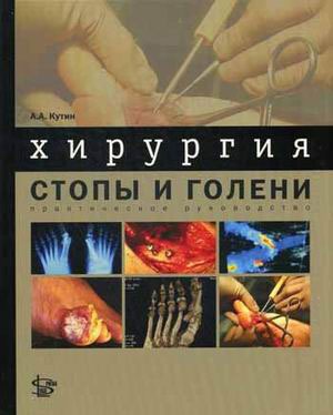 

Хирургия стопы и голени: практическое руководство. Кутин А. А.