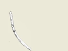 Эндотрахеальные трубки Flexicare для интубации трахеи обычные без манжеты ротовые/носовые размер 5 - изображение 1