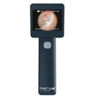 Отоскоп цифровой Medimaging Integrated Solution MIIS EOC100 Horus Digital Otoscope Full HD для диагностики слухового канала - изображение 1