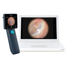 Отоскоп цифровой Medimaging Integrated Solution MIIS EOC100 Horus Digital Otoscope Full HD для диагностики слухового канала - изображение 2