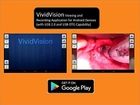 Відеоларингоскоп педіатричний VividTrac Pediatric VT-P240 - зображення 3
