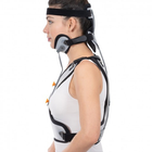 Корсет-воротник Минерва для жесткой фиксации шейного и грудного отделов позвоночника Ersamed ERS-116 M - изображение 3