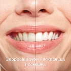 Набор электрических зубных щеток PHILIPS Sonicare DiamondClean HX9392/39 - изображение 13