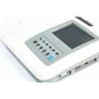 Электрокардиограф 6 канальный Carewell ECG 1106L портативный переносной аппарат ЭКГ с сенсорным экраном автоматическим анализом интерфейсы RS232 USB и Ethernet (1106L) - изображение 3