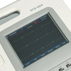 Електрокардіограф 3 канальний Carewell ECG 1103L портативний переносний апарат ЕКГ із сенсорним екраном автоматичним аналізом та інтерпретацією (1103L) - зображення 7