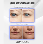 Дарсонваль косметологічний для догляду за шкірою обличчя волосся та тіла MASHELE BROM Darsonval YL-D04 газ Ar+Ne - зображення 11