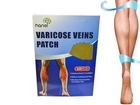 Пластир від варикозу Varicose Veins Patch 10 шт. в упаковці - зображення 5