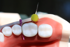 Стоматологічні матриці для жувальної групи зубів 50шт Super Mat - зображення 3
