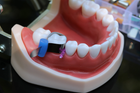 Стоматологічні матриці для жувальної групи зубів 50шт Super Mat - изображение 8