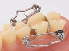 BESTSELLER Набор из 25 зубных матриц Walser® с щипцами и лотком для стерилизации. - изображение 2
