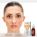Peeling kwasowy do twarzy Floslek Dermo Expert White & Beauty 30 ml (5905043005423) - obraz 5