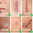 Гель проти шрамів та рубців Cicatricure для обличчя та тіла (28 гр) - зображення 6