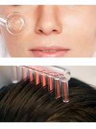 Дарсонваль для догляду шкірою обличчя за волоссям Косметологічний апарат для дарсонвалізації в домашніх умовах 5 насадок Svitae - зображення 9
