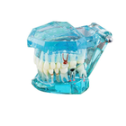 Модель стоматологічна демонстраційна (розбірна) - зображення 5