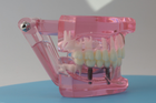 Модель стоматологічна демонстраційна (розбірна) рожева - зображення 3