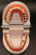 Модель демонстраційна стоматологічна з патологіями - зображення 1