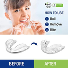 Набор капа зубная ANNEK 2 размера стоматологическая для лечение бруксизма футляр 4 шт (К-4) - изображение 5