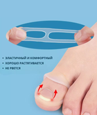 Корректор вросшего ногтя при деформации ногтевой пластины для коррекции ногтя 2 шт (AN)32467 2ф - изображение 4
