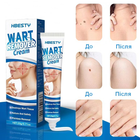 Косметичний крем для усунення папілом та бородавок Wart Remover Cream - изображение 4