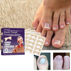 Набір еластичних пластирів Elastic Toenail Correction Sticker для безболісного виправлення врослих нігтів (50 шт.)