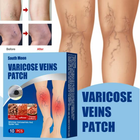 Пластырь от варикоза набор 10 штук Varicose Veins Patch на растительных компонентах для ног, от отеков